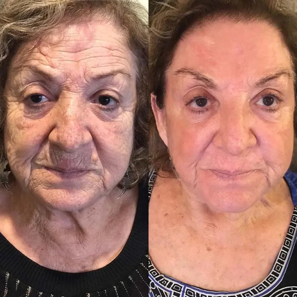 Alicia Michaels Before and After