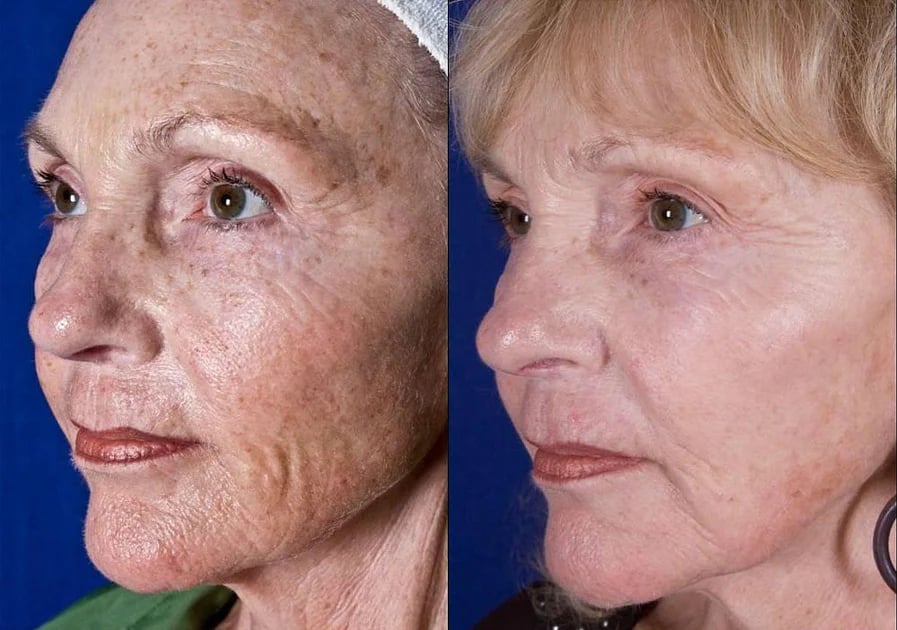 Marlene Rivera Before After