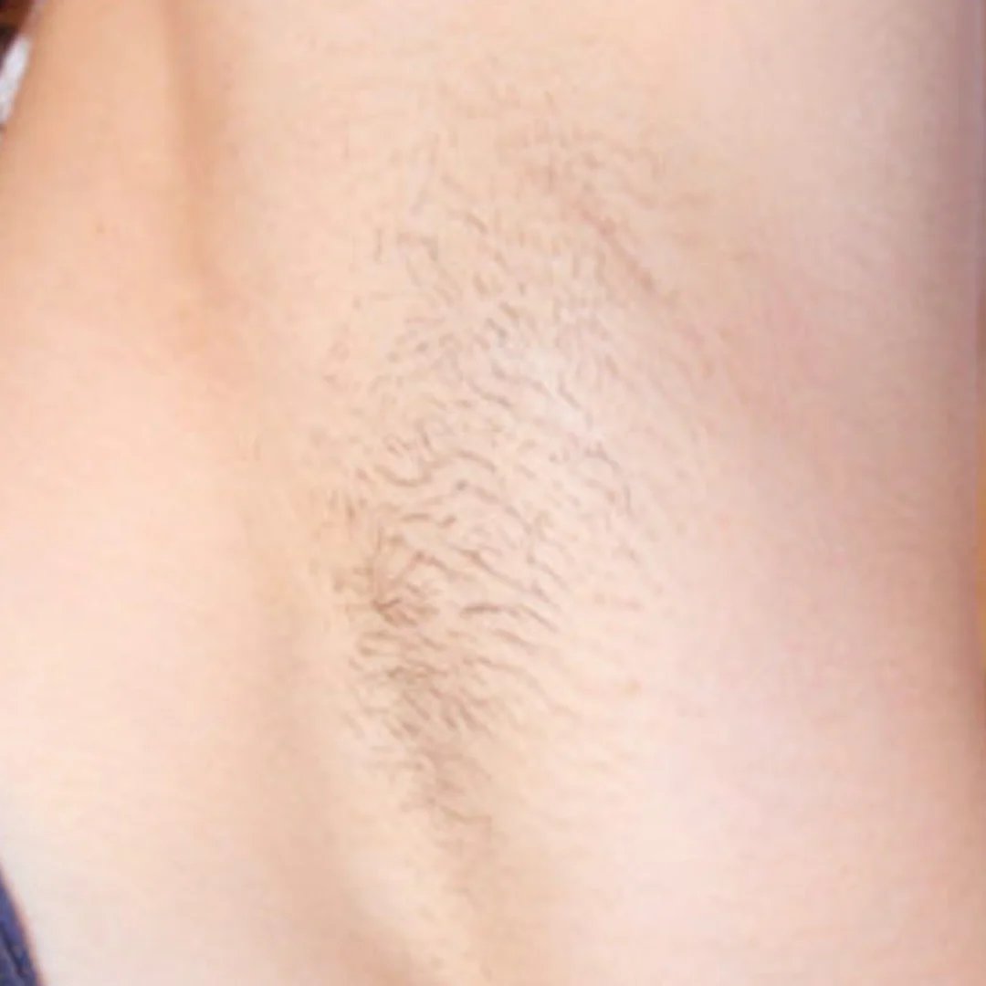 Fórmula para Depilação (7).png__PID:389fe7ca-0b51-478f-b4dc-783574d88240